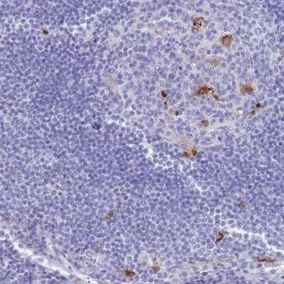 Immunohistochemistry-Paraffin: Tissue alpha-L-Fucosidase/FUCA1 Antibody [NBP2-32044]