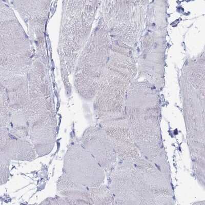 Immunohistochemistry-Paraffin: Tissue alpha-L-Fucosidase/FUCA1 Antibody [NBP2-32044]