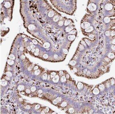 Immunohistochemistry-Paraffin: Tissue alpha-L-Fucosidase/FUCA1 Antibody [NBP2-58170]