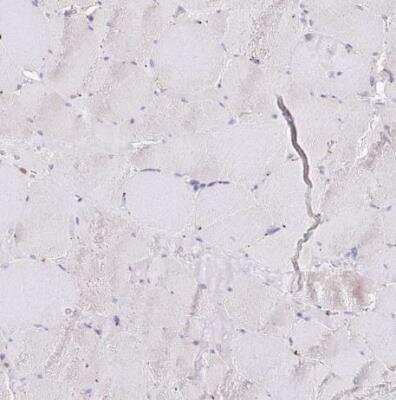 Immunohistochemistry-Paraffin: Tissue alpha-L-Fucosidase/FUCA1 Antibody [NBP2-58170]