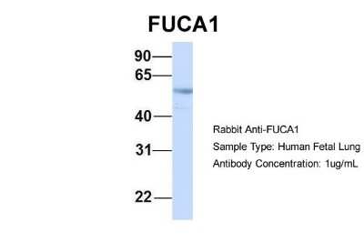 Western Blot: Tissue alpha-L-Fucosidase/FUCA1 Antibody [NBP1-57993]