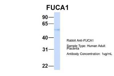 Western Blot: Tissue alpha-L-Fucosidase/FUCA1 Antibody [NBP1-57993]