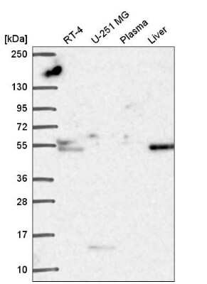 Western Blot: Tissue alpha-L-Fucosidase/FUCA1 Antibody [NBP2-58170]