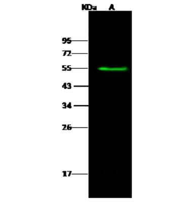 Western Blot: Tissue alpha-L-Fucosidase/FUCA1 Antibody [NBP3-00209]