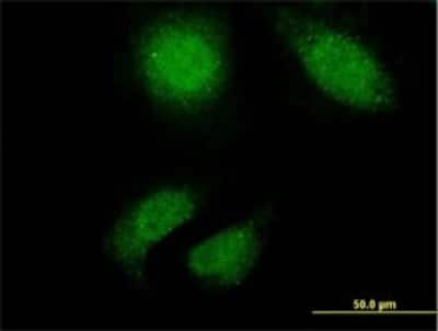 Immunocytochemistry/ Immunofluorescence: Titin Antibody (2B3) [H00007273-M02]