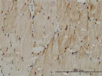 Immunohistochemistry-Paraffin: Titin Antibody (2B3) [H00007273-M02]