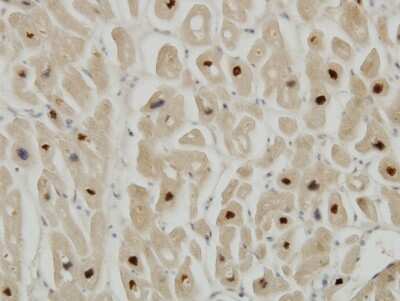 Immunohistochemistry-Paraffin: Titin Antibody (6H5) [H00007273-M09]