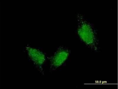 Immunocytochemistry/ Immunofluorescence: Titin Antibody (7D3) [H00007273-M06]