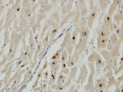 Immunohistochemistry-Paraffin: Titin Antibody (7D3) [H00007273-M06]