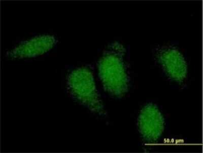 Immunocytochemistry/ Immunofluorescence: Titin Antibody (8G9) [H00007273-M01]