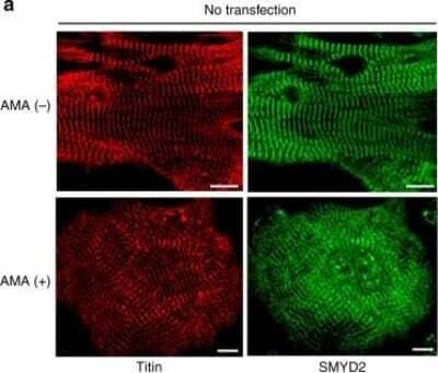Immunocytochemistry/ Immunofluorescence: Titin Antibody [NBP1-88071]