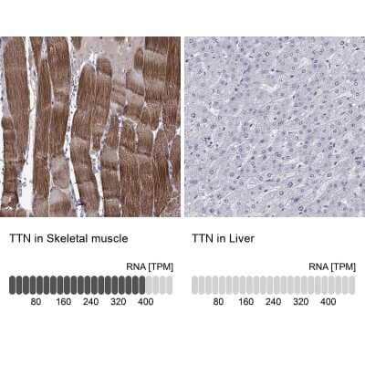 Immunohistochemistry-Paraffin: Titin Antibody [NBP1-88071]