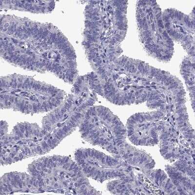 Immunohistochemistry-Paraffin: Titin Antibody [NBP1-88071]