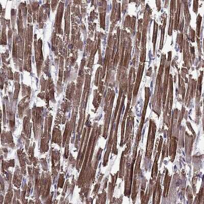 Immunohistochemistry-Paraffin: Titin Antibody [NBP1-88071]