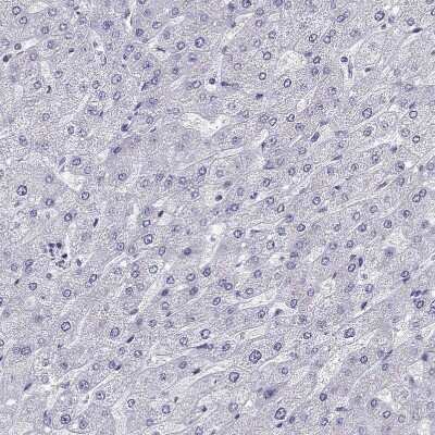 Immunohistochemistry-Paraffin: Titin Antibody [NBP1-88071]