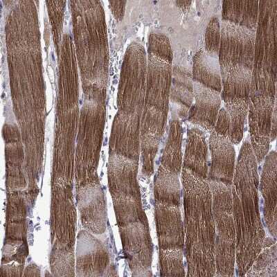 Immunohistochemistry-Paraffin: Titin Antibody [NBP1-88071]