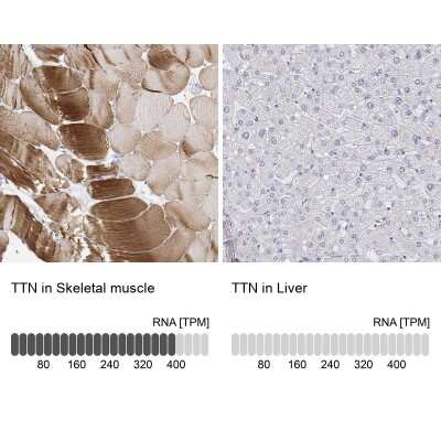 Immunohistochemistry-Paraffin: Titin Antibody [NBP2-62600]