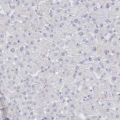 Immunohistochemistry-Paraffin: Titin Antibody [NBP2-62600]