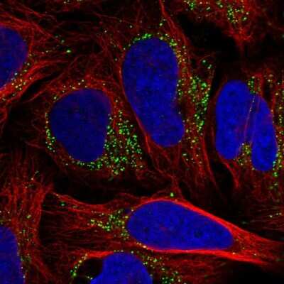 Immunocytochemistry/ Immunofluorescence: Tm9sf3 Antibody [NBP1-80736]