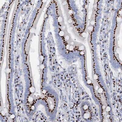 Immunohistochemistry-Paraffin: Tm9sf3 Antibody [NBP1-80736]