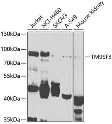 Western Blot: Tm9sf3 AntibodyBSA Free [NBP2-94225]