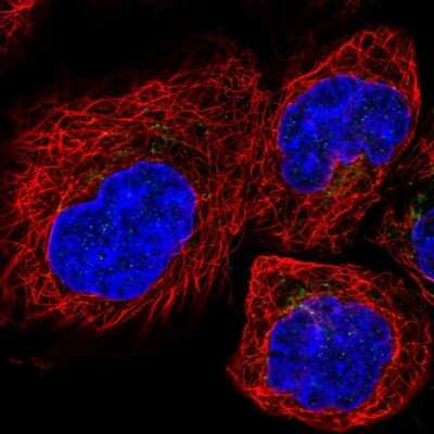 Immunocytochemistry/ Immunofluorescence: Tmp21/p23 Antibody [NBP2-47600]