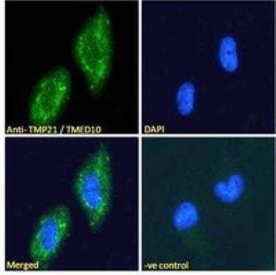 Immunocytochemistry/ Immunofluorescence: Tmp21/p23 Antibody [NBP2-75965]