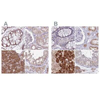 Immunohistochemistry-Paraffin: Tmp21/p23 Antibody [NBP2-47600]