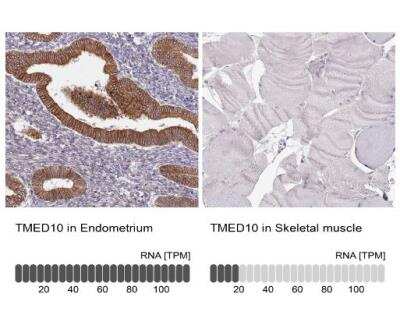 Immunohistochemistry-Paraffin: Tmp21/p23 Antibody [NBP2-47600]