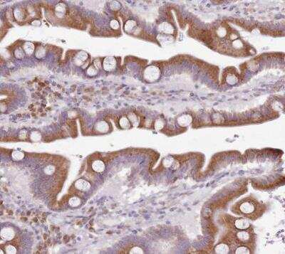 Immunohistochemistry-Paraffin: Tmp21/p23 Antibody [NBP2-47600]