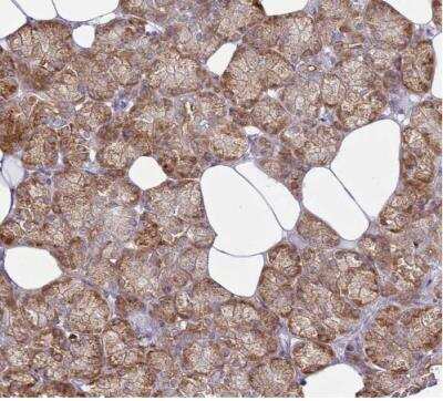 Immunohistochemistry-Paraffin: Tmp21/p23 Antibody [NBP2-47600]