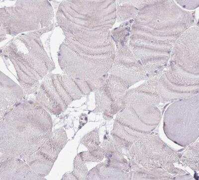 Immunohistochemistry-Paraffin: Tmp21/p23 Antibody [NBP2-47600]