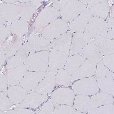 Immunohistochemistry-Paraffin: Tmp21/p23 Antibody [NBP2-48969]