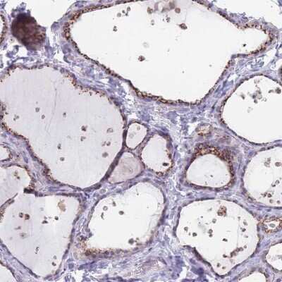 Immunohistochemistry-Paraffin: Tmp21/p23 Antibody [NBP2-48969]