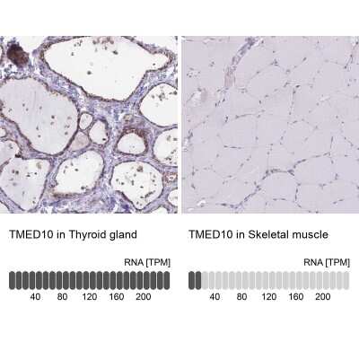 Immunohistochemistry-Paraffin: Tmp21/p23 Antibody [NBP2-48969]