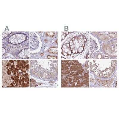 Immunohistochemistry-Paraffin: Tmp21/p23 Antibody [NBP2-48969]