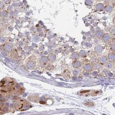 Immunohistochemistry-Paraffin: Tmp21/p23 Antibody [NBP2-48969]
