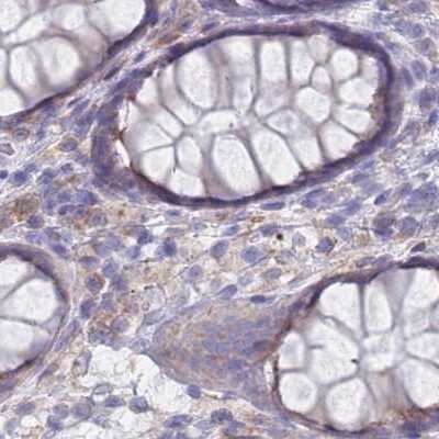 Immunohistochemistry-Paraffin: Tmp21/p23 Antibody [NBP2-48969]