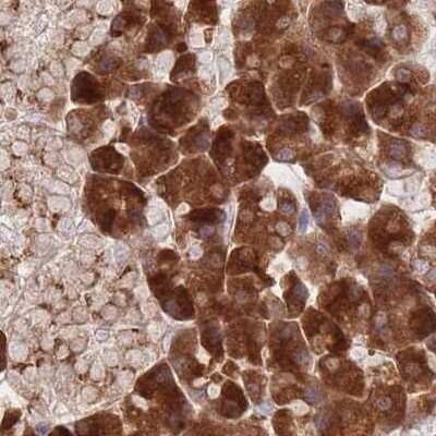 Immunohistochemistry-Paraffin: Tmp21/p23 Antibody [NBP2-48969]