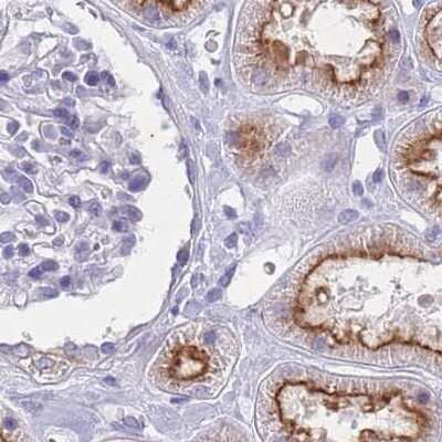 Immunohistochemistry-Paraffin: Tmp21/p23 Antibody [NBP2-48969]