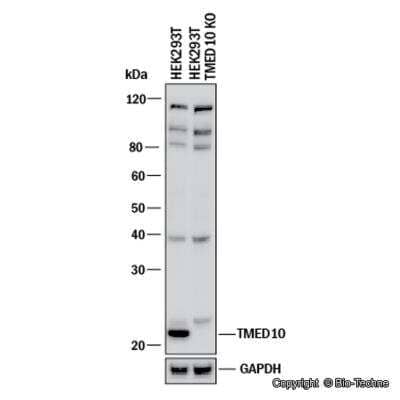 Knockdown Validated: Tmp21/p23 Antibody - BSA Free [NB110-57587]