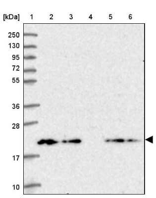 Western Blot: Tmp21/p23 Antibody [NBP2-47600]