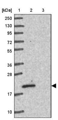 Western Blot: Tmp21/p23 Antibody [NBP2-48969]