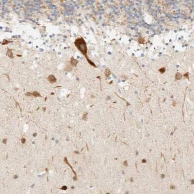 Immunohistochemistry-Paraffin: Tnk1 Antibody [NBP1-86477]