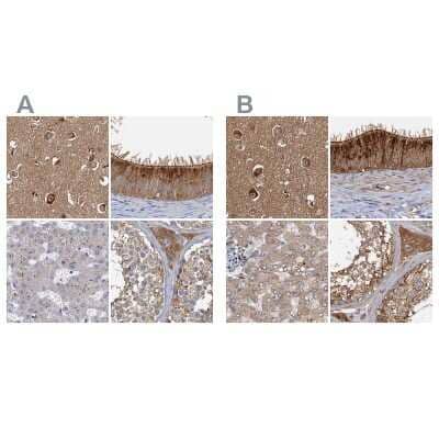 Immunohistochemistry-Paraffin: Tollip Antibody [NBP1-81596]