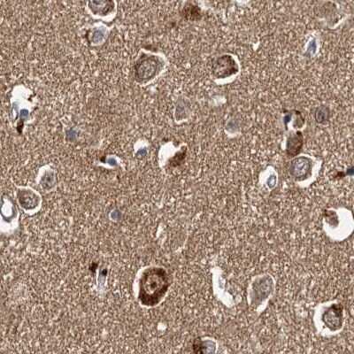 Immunohistochemistry-Paraffin: Tollip Antibody [NBP1-81596]