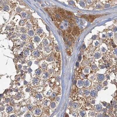 Immunohistochemistry-Paraffin: Tollip Antibody [NBP1-81596]