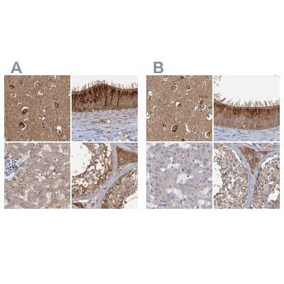 Immunohistochemistry-Paraffin: Tollip Antibody [NBP1-81597]