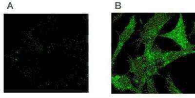 Immunocytochemistry/ Immunofluorescence: Tollip Antibody (Kimmy-2) [NBP1-97632]