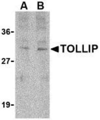 Western Blot: Tollip AntibodyBSA Free [NBP1-76681]